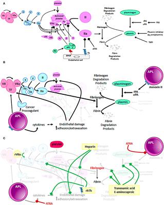 Coagulopathy in Acute Promyelocytic Leukemia: Can We Go Beyond Supportive Care?